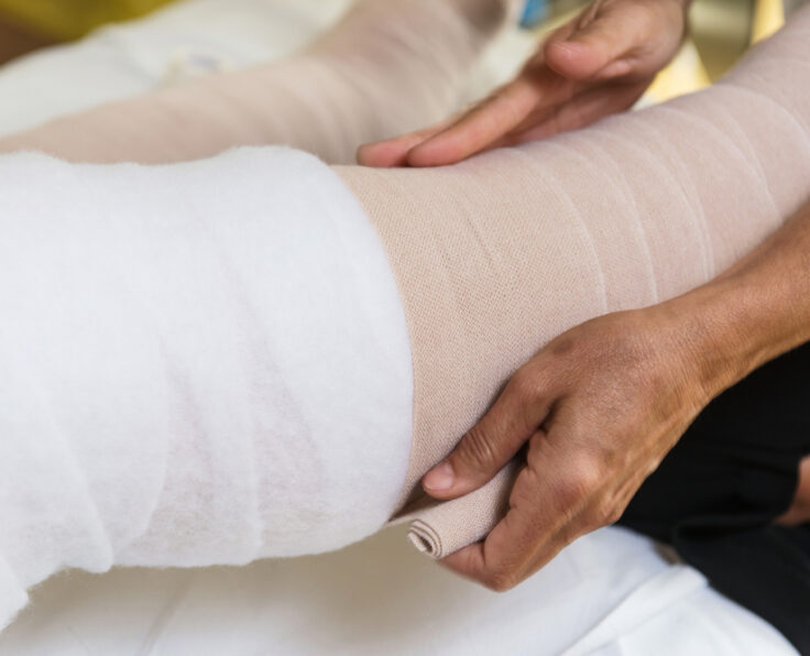 Bandages,Legs,And,Manual,Lymphatic,Drainage,Massage,For,A,Patient