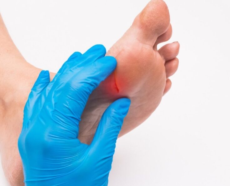 Wound Debridement (2)
