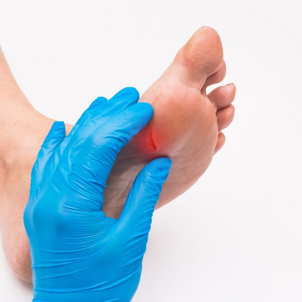 Bedsores Treatment Jacksonville