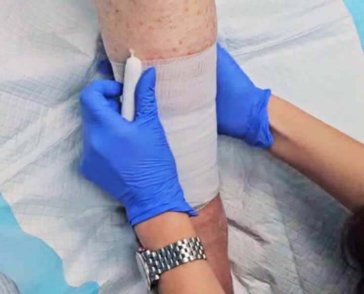 Foot and Leg Wound Treatment in St Augustine