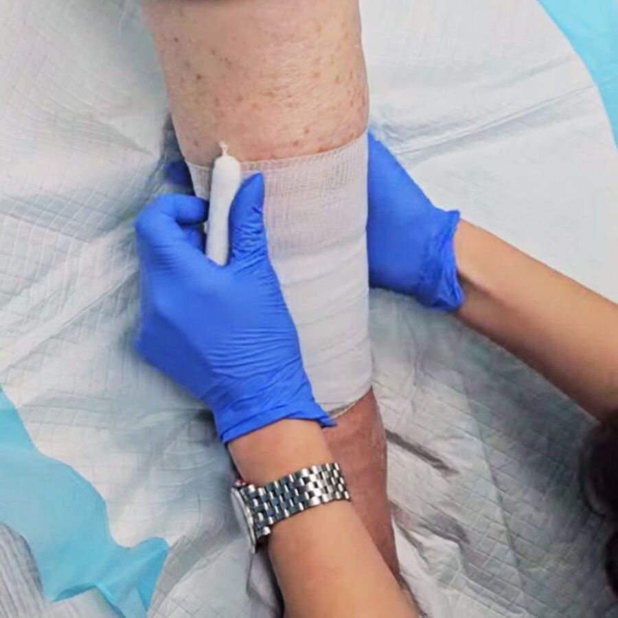 Foot and Leg Wound Treatment in St Augustine