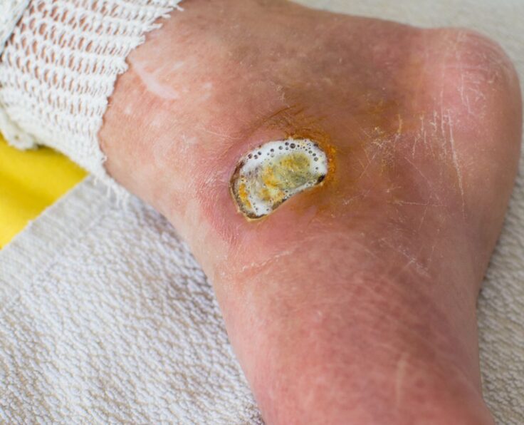 foot care in st augustine