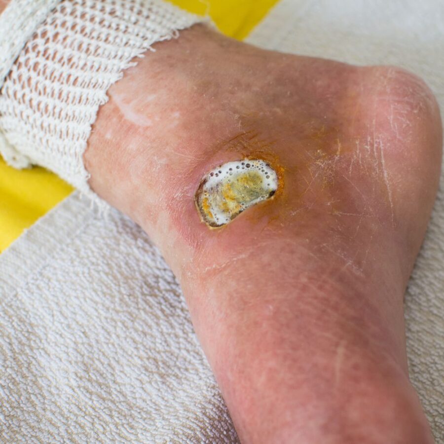 foot care in st augustine